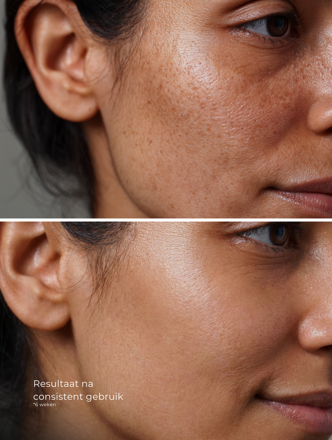 Dark Spot Face Cream