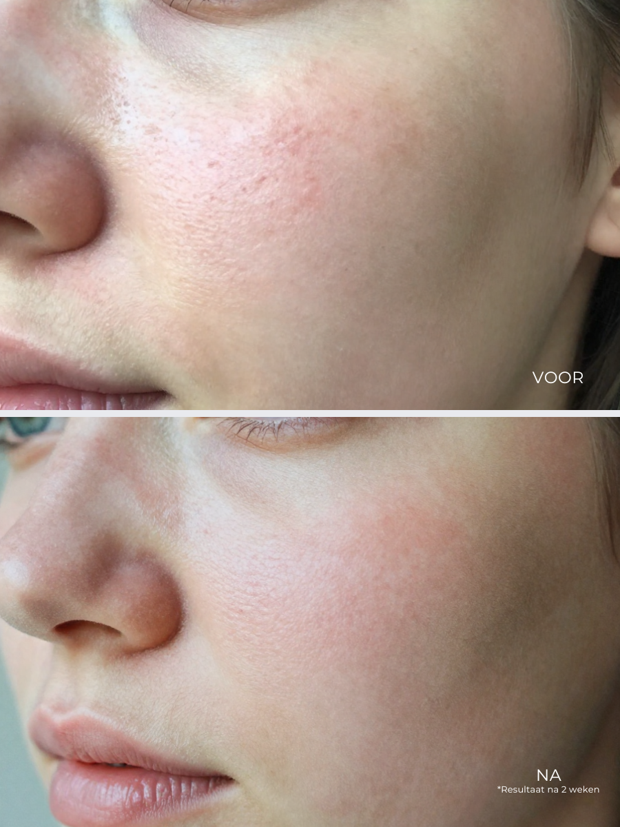 Natural Retinol Alternative Oil Serum (30 ml)