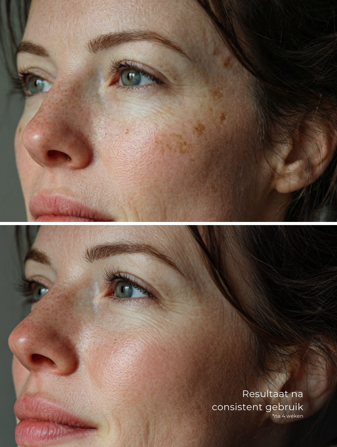 Targeted Dark Spot Care, 1% Kojic Acid