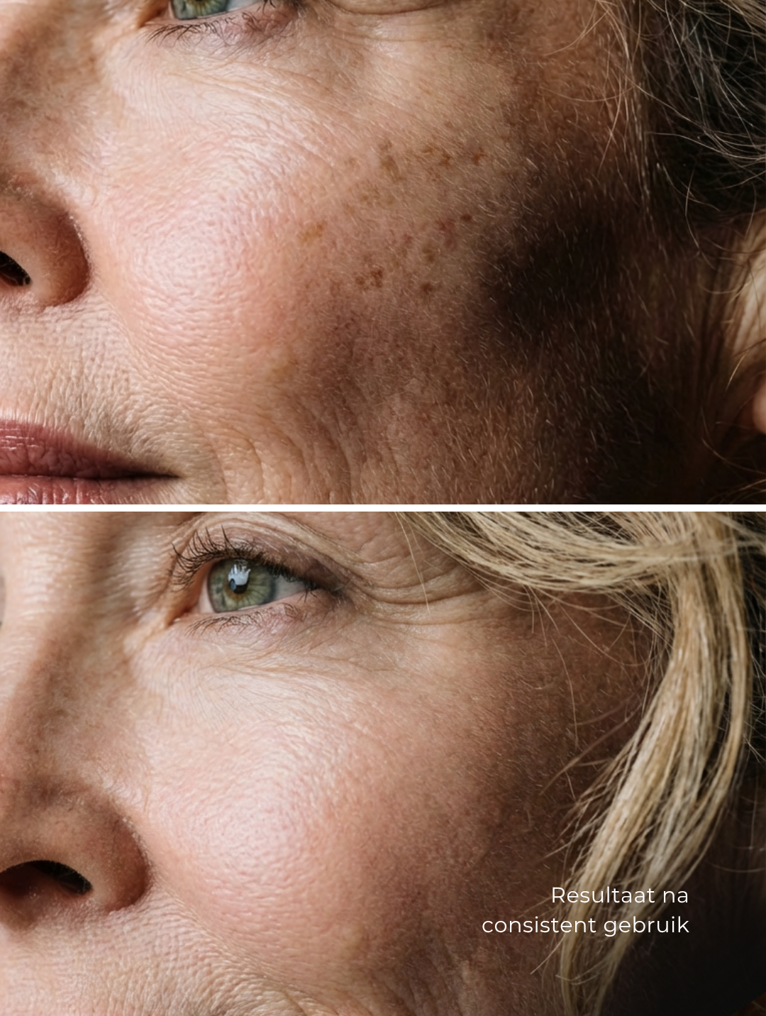Targeted Dark Spot Care